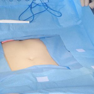 Drape Set Gynae